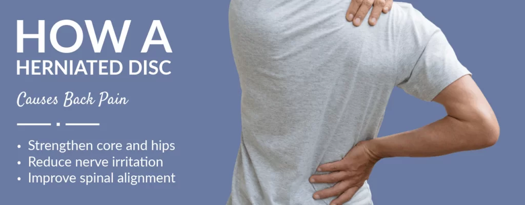 How a Herniated Disc Causes Back Pain